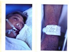 郑州大学第一附属医院被指输错血型致病人死亡成被告